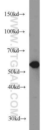 Thumbnail_GEFT Mouse anti-Human, Mouse, Rat, Clone: 5A11F8, Proteintech 150 &mu;L;