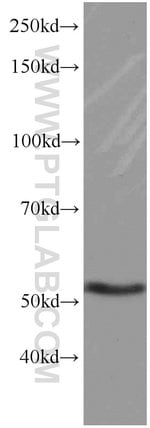 Thumbnail_GEFT Mouse anti-Human, Mouse, Rat, Clone: 5A11F8, Proteintech 150 &mu;L;