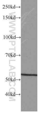 Thumbnail_GEFT Mouse anti-Human, Mouse, Rat, Clone: 5A11F8, Proteintech 150 &mu;L;