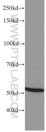 Thumbnail_GEFT Mouse anti-Human, Mouse, Rat, Clone: 5A11F8, Proteintech 150 &mu;L;