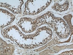 MAD2L1 Mouse anti-Human, Clone: 2F5F12, Proteintech 150 &mu;L; Unconjugated:Antibodies,