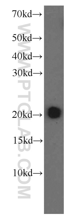 MAD2L1 Mouse anti-Human, Clone: 2F5F12, Proteintech 150 &mu;L; Unconjugated:Antibodies,