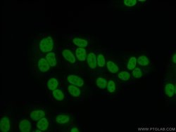 Transketolase Mouse anti-Human, Clone: 3E2F3, Proteintech:Antibodies:Primary
