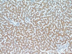 Transketolase Mouse anti-Human, Clone: 3E2F3, Proteintech:Antibodies:Primary