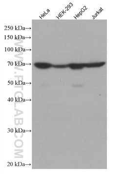 Transketolase Mouse anti-Human, Clone: 3E2F3, Proteintech:Antibodies:Primary