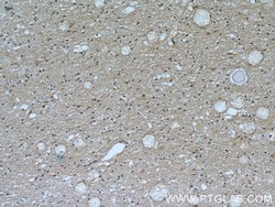 Transketolase Mouse anti-Human, Clone: 3E2F3, Proteintech:Antibodies:Primary