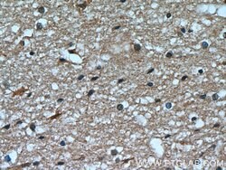 Transketolase Mouse anti-Human, Clone: 3E2F3, Proteintech:Antibodies:Primary