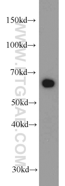 Transketolase Mouse anti-Human, Clone: 3E2F3, Proteintech:Antibodies:Primary