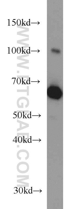 Transketolase Mouse anti-Human, Clone: 3E2F3, Proteintech:Antibodies:Primary