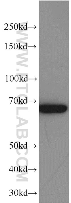 Transketolase Mouse anti-Human, Clone: 3E2F3, Proteintech:Antibodies:Primary