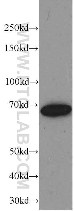 Transketolase Mouse anti-Human, Clone: 3E2F3, Proteintech:Antibodies:Primary