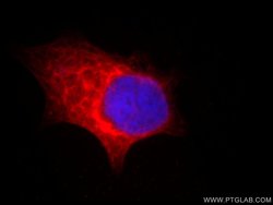 TPPII Mouse anti-Human, Clone: 5H6F11, Proteintech:Anticorps:Anticorps