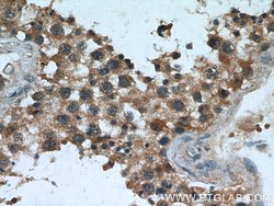 TPPII Mouse anti-Human, Clone: 5H6F11, Proteintech:Anticorps:Anticorps