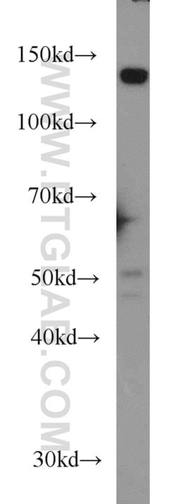 TPPII Mouse anti-Human, Clone: 5H6F11, Proteintech:Anticorps:Anticorps