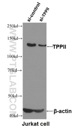 TPPII Mouse anti-Human, Clone: 5H6F11, Proteintech:Anticorps:Anticorps