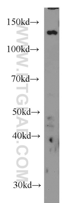 TPPII Mouse anti-Human, Clone: 5H6F11, Proteintech:Anticorps:Anticorps