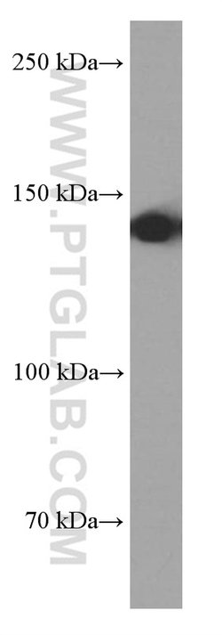 TPPII Mouse anti-Human, Clone: 5H6F11, Proteintech:Anticorps:Anticorps