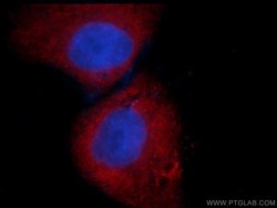 CDC6 Mouse anti-Human, Mouse, Rat, Clone: 6F12D2, Proteintech 150 &mu;L;