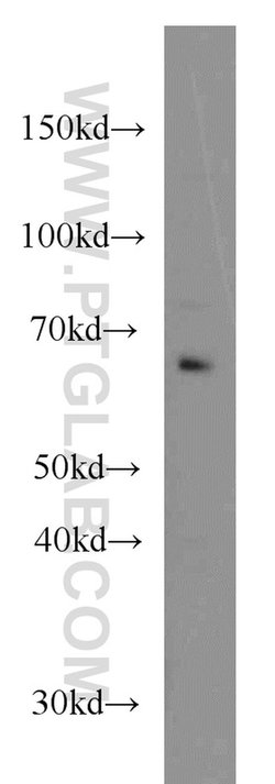 CDC6 Mouse anti-Human, Mouse, Rat, Clone: 6F12D2, Proteintech 150 &mu;L;