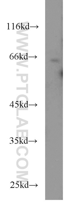 CDC6 Mouse anti-Human, Mouse, Rat, Clone: 6F12D2, Proteintech 150 &mu;L;