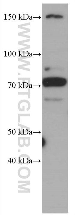 CDC6 Mouse anti-Human, Mouse, Rat, Clone: 6F12D2, Proteintech 150 &mu;L;