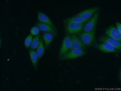 CYB5R3 Mouse anti-Human, Clone: 9C4D10, Proteintech 150 &mu;L; Unconjugated:Antibodies,