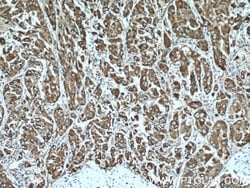 CYB5R3 Mouse anti-Human, Clone: 9C4D10, Proteintech 150 &mu;L; Unconjugated:Antibodies,