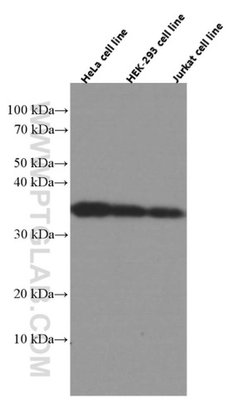 CYB5R3 Mouse anti-Human, Clone: 9C4D10, Proteintech 150 &mu;L; Unconjugated:Antibodies,