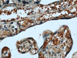 CYB5R3 Mouse anti-Human, Clone: 9C4D10, Proteintech 150 &mu;L; Unconjugated:Antibodies,