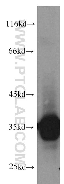 CYB5R3 Mouse anti-Human, Clone: 9C4D10, Proteintech 150 &mu;L; Unconjugated:Antibodies,