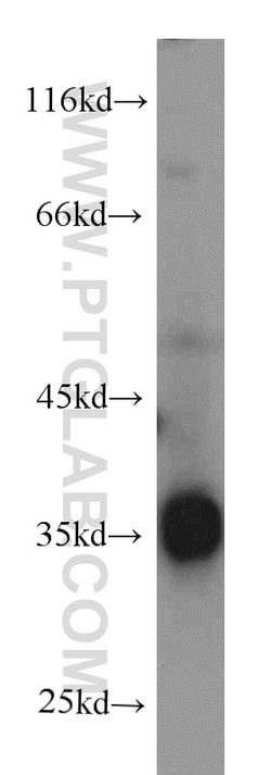 CYB5R3 Mouse anti-Human, Clone: 9C4D10, Proteintech 150 &mu;L; Unconjugated:Antibodies,
