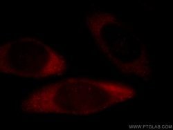 EIF3M Mouse anti-Human, Clone: 2A12B2, Proteintech:Anticuerpos:Anticuerpos