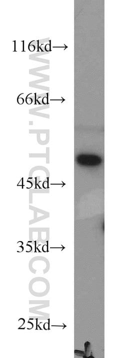 RNH1 Mouse anti-Human, Clone: 4A1C4, Proteintech 150 &mu;L; Unconjugated:Antibodies,