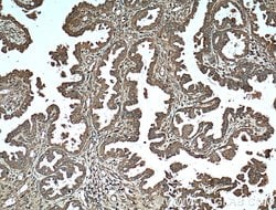 Protein C inhibitor Mouse anti-Human, Clone: 2H6G2, Proteintech:Antibodies:Primary