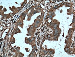 Protein C inhibitor Mouse anti-Human, Clone: 2H6G2, Proteintech:Antibodies:Primary