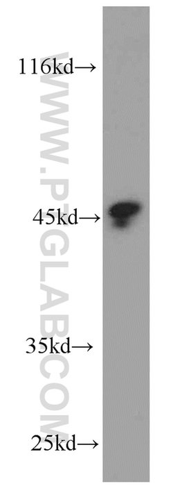 Protein C inhibitor Mouse anti-Human, Clone: 2H6G2, Proteintech:Antibodies:Primary