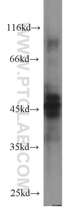 Protein C inhibitor Mouse anti-Human, Clone: 2H6G2, Proteintech