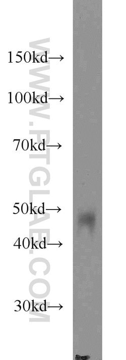 Protein C inhibitor Mouse anti-Human, Clone: 2H6G2, Proteintech:Antibodies:Primary