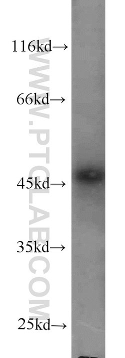 Protein C inhibitor Mouse anti-Human, Clone: 2H6G2, Proteintech:Antibodies:Primary