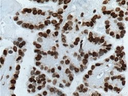 TTF1 Mouse anti-Human, Porcine, Clone: 2C8F3, Proteintech:Antibodies:Primary