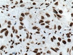 TTF1 Mouse anti-Human, Porcine, Clone: 2C8F3, Proteintech:Antibodies:Primary