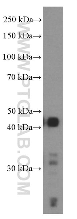 TTF1 Mouse anti-Human, Porcine, Clone: 2C8F3, Proteintech:Antibodies:Primary