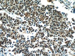 TTF1 Mouse anti-Human, Porcine, Clone: 2C8F3, Proteintech:Antibodies:Primary