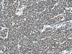 TTF1 Mouse anti-Human, Porcine, Clone: 2C8F3, Proteintech:Antibodies:Primary