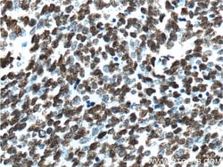 TTF1 Mouse anti-Human, Porcine, Clone: 2C8F3, Proteintech:Antibodies:Primary