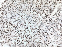 TTF1 Mouse anti-Human, Porcine, Clone: 2C8F3, Proteintech:Antibodies:Primary
