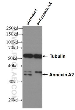 Annexin A2 Mouse anti-Human, Clone: 1C1E12, Proteintech:Anticorps:Anticorps