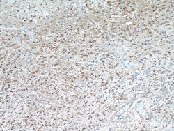 Annexin A2 Mouse anti-Human, Clone: 1C1E12, Proteintech:Anticorps:Anticorps