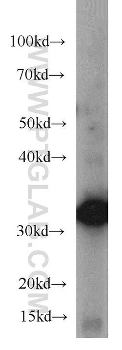Annexin A2 Mouse anti-Human, Clone: 1C1E12, Proteintech:Anticorps:Anticorps