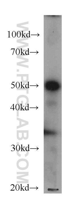 ATP5A1 Mouse anti-Human, Mouse, Non-human primate, Rat, Clone: 1B10H3,